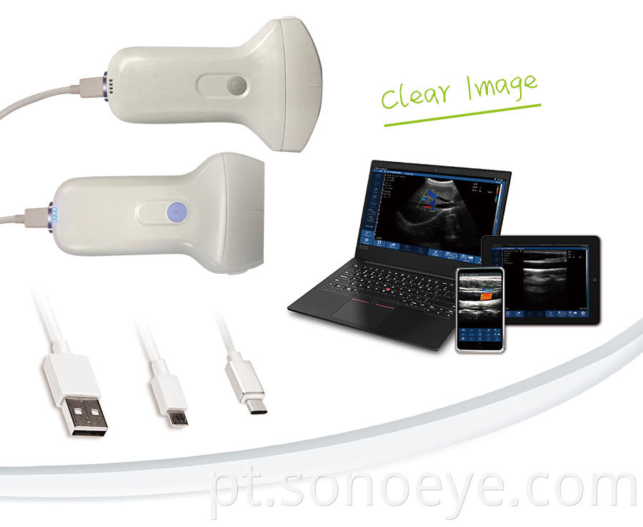 USB ultrasound